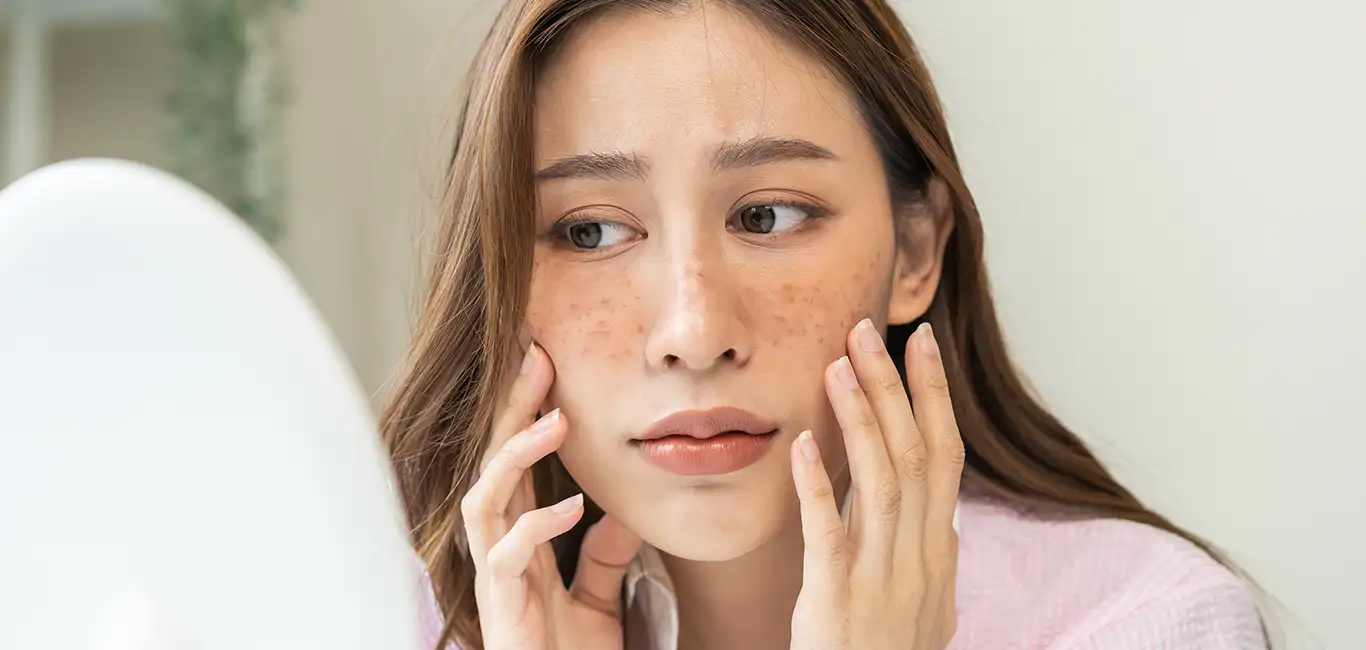 breakouts